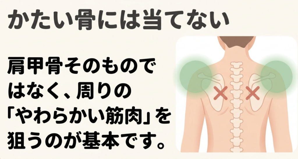 肩甲骨と背骨にバツ印を付け、マッサージガンを当てる周囲の柔らかい筋肉を緑色で示した図